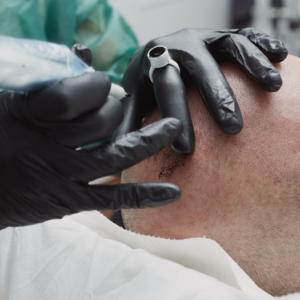 Formation: Micropigmentation capillaire