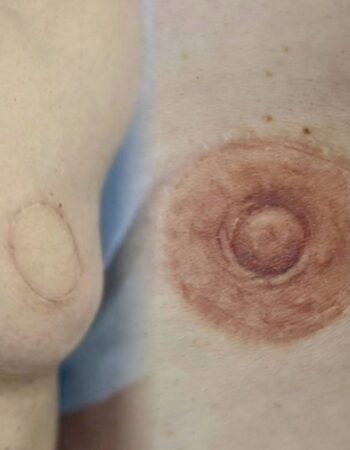 quand_le_tatouage_devient_une_therapie pour_lame_9