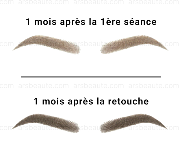 Pourquoi l’état de votre peau détermine le résultat et la cicatrisation du maquillage permanent